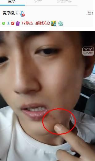 yy主播天佑打架视频,网络红人暴力冲突引发热议